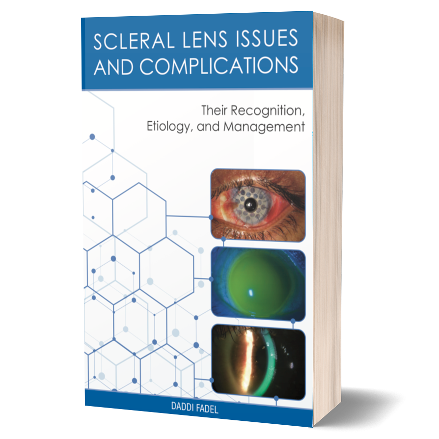 Scleral Lens Issues and Complications - Their Recognition, Etiology, and Management Full Print Book