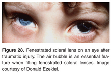 Load image into Gallery viewer, Chapter 5: Subdivision of Issues and Complication Based on Two Factors (E-Book)