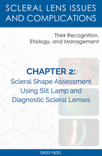 Load image into Gallery viewer, Chapter 2: Scleral Shape Assessment Using Slit Lamp and Diagnostic Scleral Lenses (E-Book)