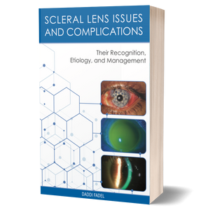 Scleral Lens Issues and Complications - Their Recognition, Etiology, and Management Full Print Book