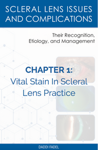 Chapter 1: Vital Stain In Scleral lens Practice (E-Book)