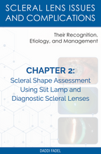 Load image into Gallery viewer, Chapter 2: Scleral Shape Assessment Using Slit Lamp and Diagnostic Scleral Lenses (E-Book)
