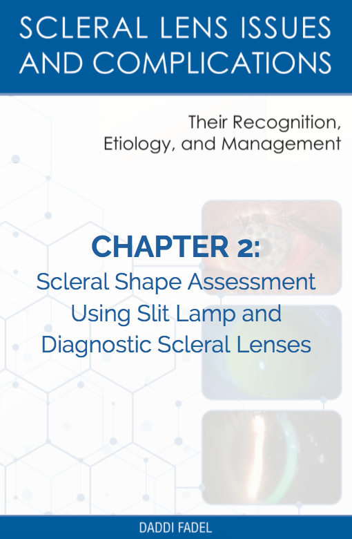 Chapter 2: Scleral Shape Assessment Using Slit Lamp and Diagnostic Scleral Lenses (E-Book)