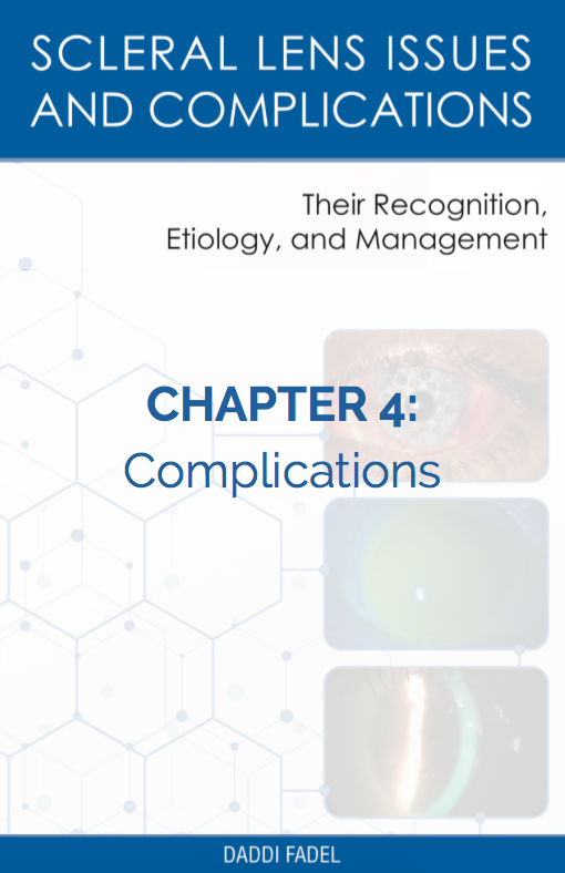 Chapter 4: Complications (E-Book)